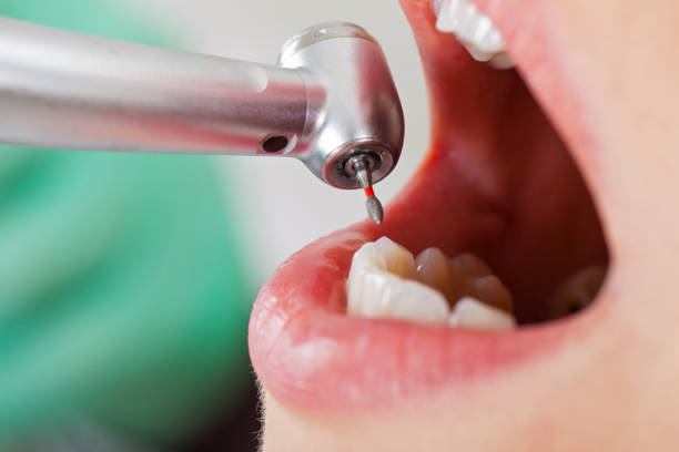Best Emergency Treatment for Toothache in Sharpsburg, NC